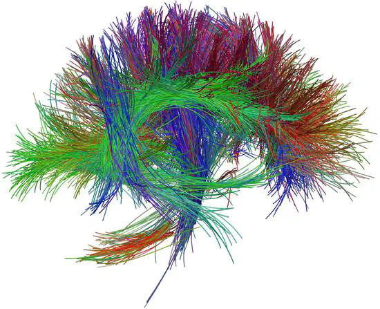 Diffusion MRI Q-ball CSA-ODF and Hough Tractography